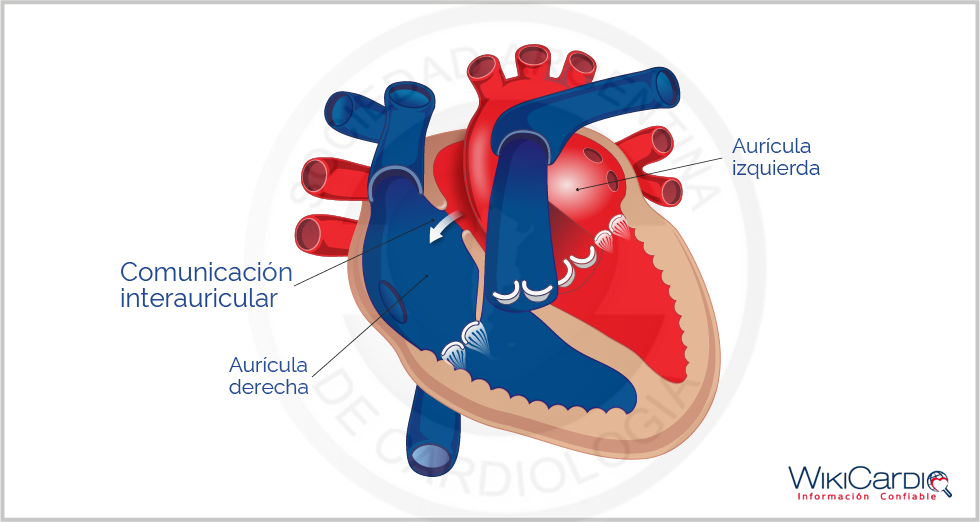 Img-comunicacion-interauricular-1.png