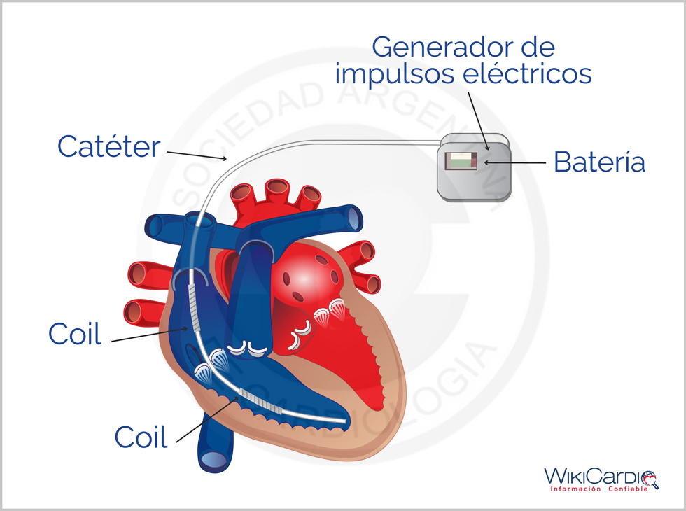Img-cardiodesfibrilador.png
