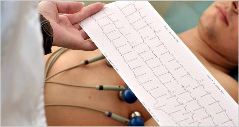 Img-electrocardiograma.png