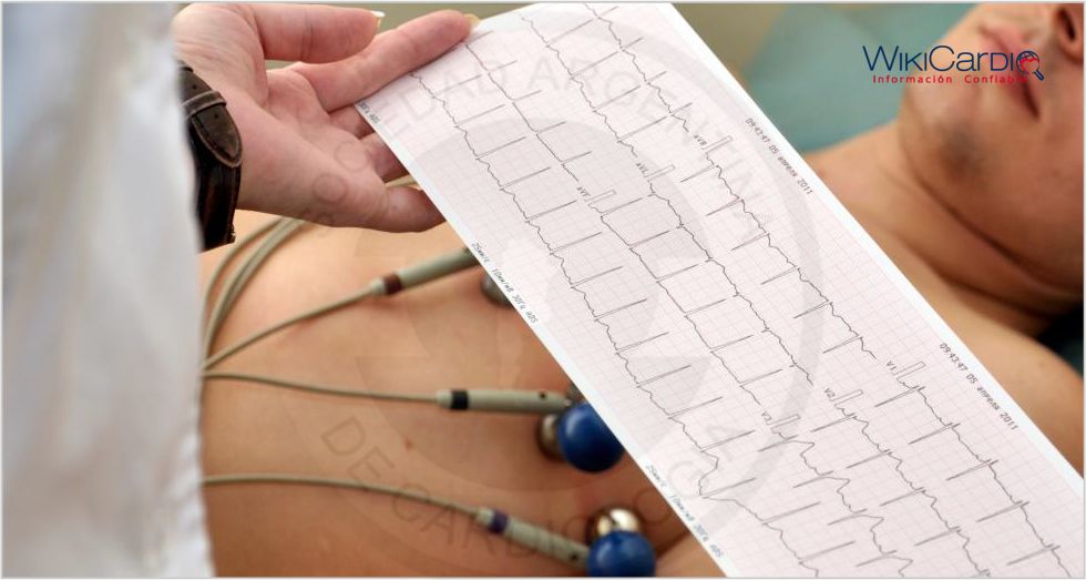 Img-electrocardiograma-1.png