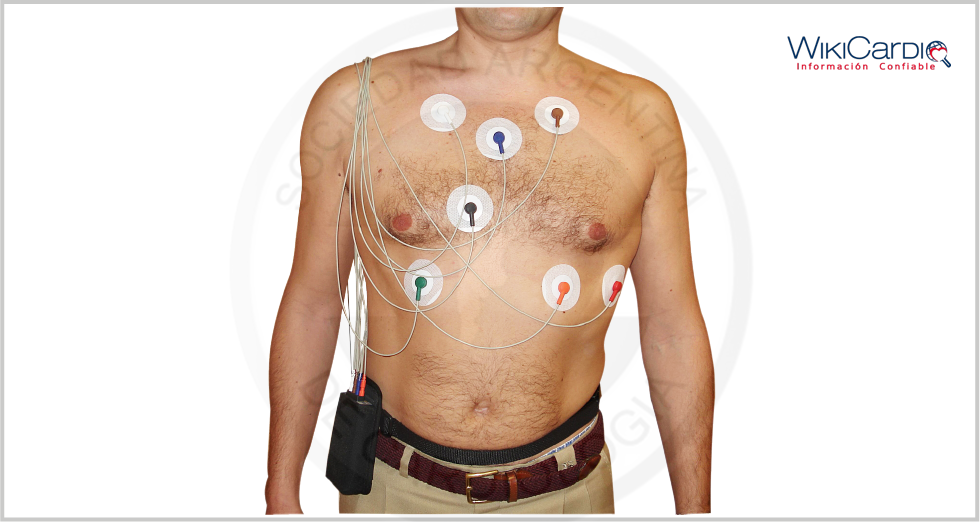 Img-holter-1.png