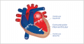Img-comunicacion-interventricular.png