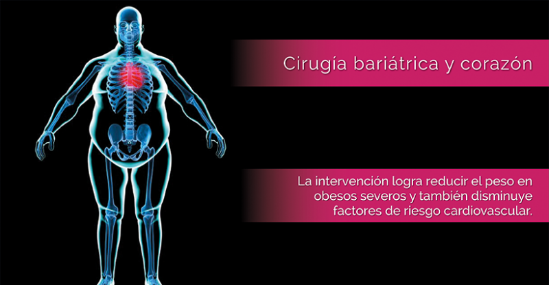 Archivo:Img-cirugia-bariatrica-y-corazon-2.png