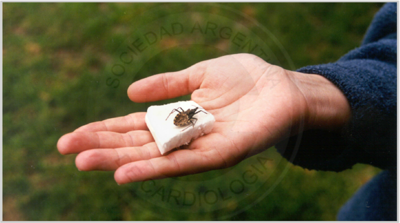 Archivo:Img-chagas-2.png