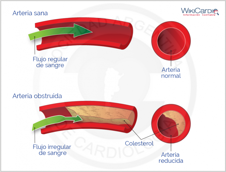 Archivo:Img-colesterol-1.png