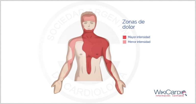 Archivo:Img-angina-de-pecho-6.png